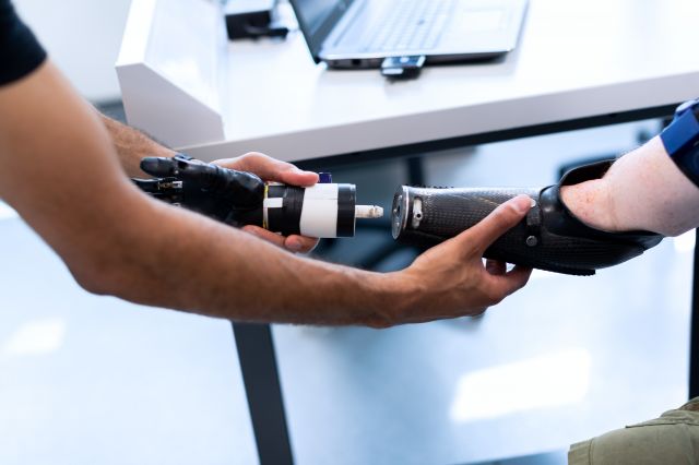 Bionic prostheses project